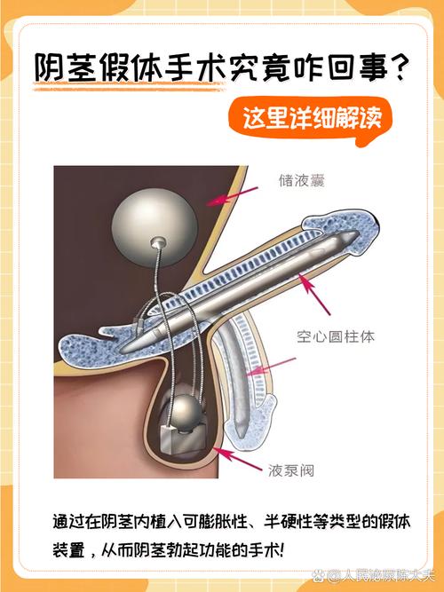 seo硅胶的简单介绍